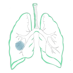 Hydrated Cysts