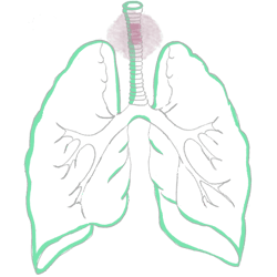 Tracheal Tumor + Complications